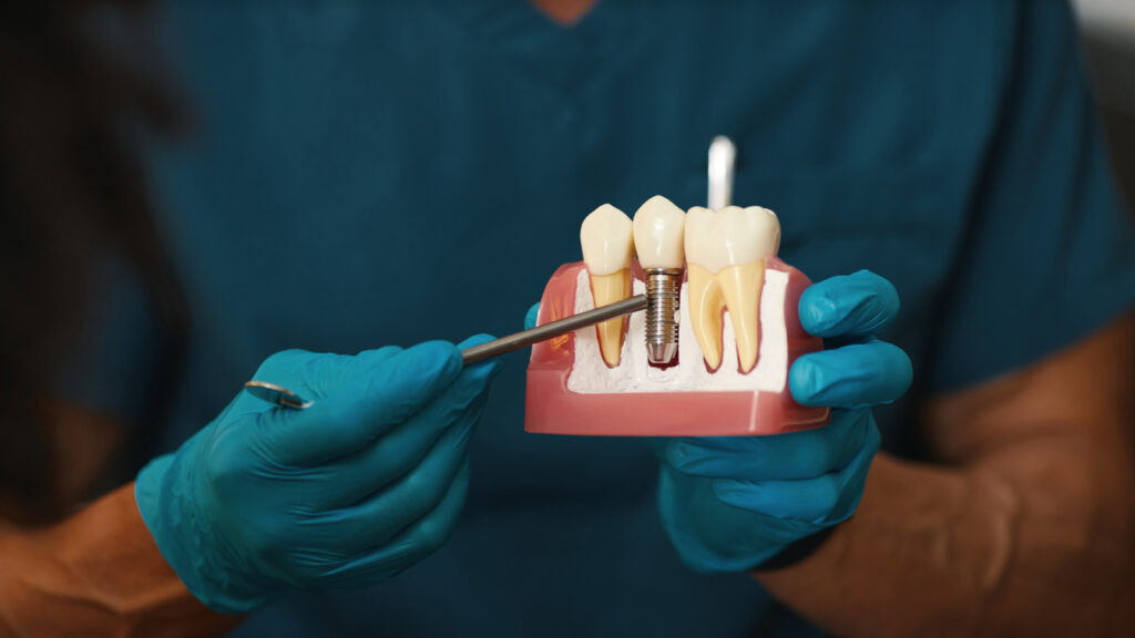 Dentist explaining dental implant process