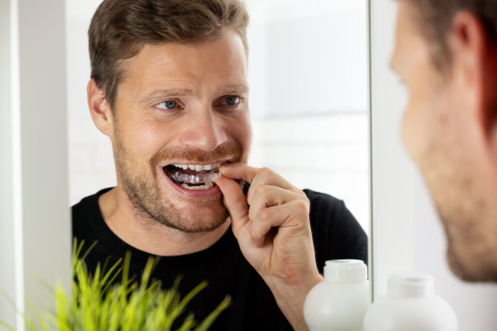 man inserting transparent invisible dental aligners for crooked teeth straightening